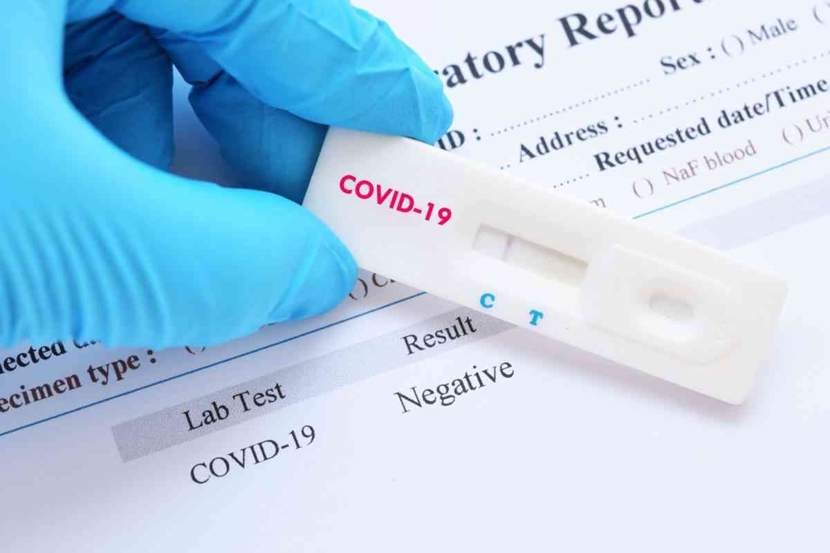 COVID-19 test results