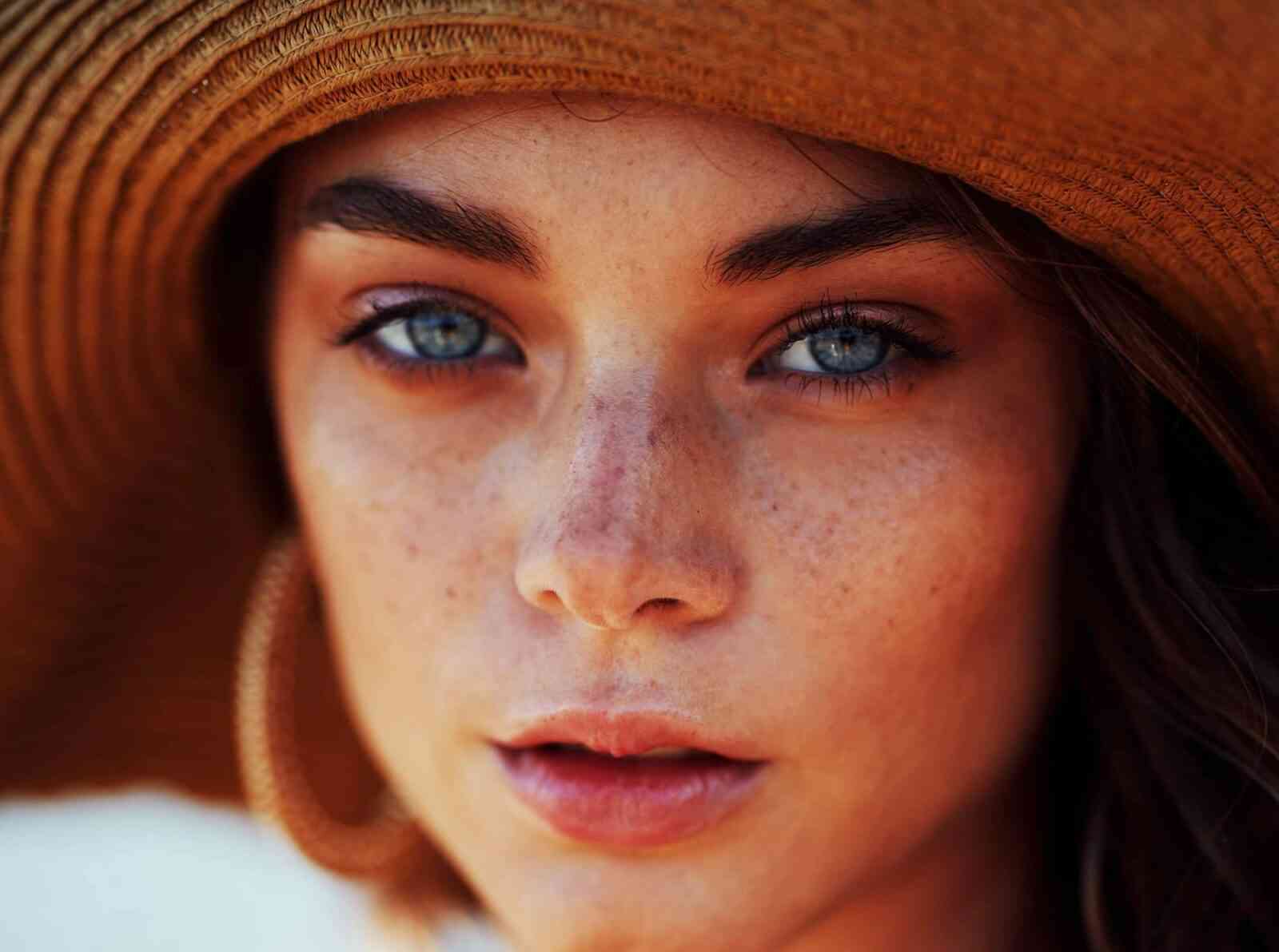 Woman with photosensitivity skin rash wearing a sun hat.