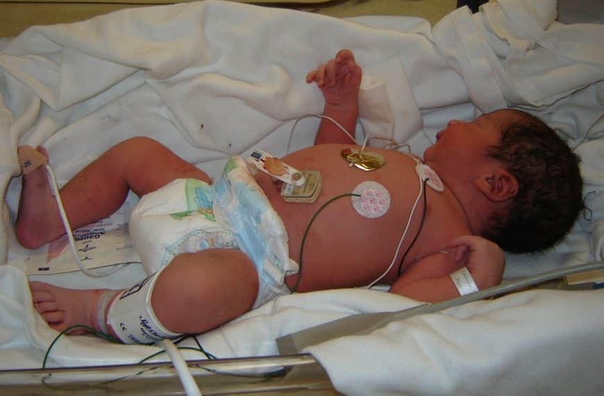 The Link Between Birth Complications and Autism