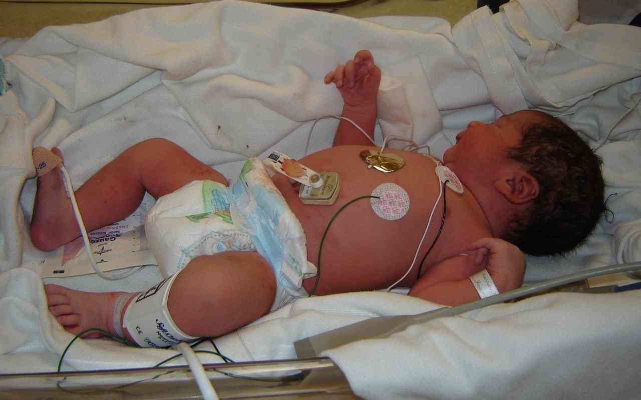 Baby in NICU due to birth complications that increase the risk for autism.