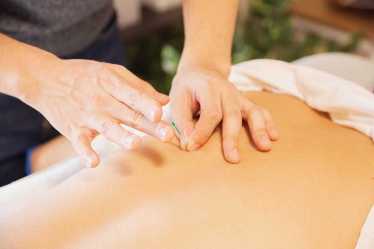 Person receiving acupuncture for mental health.