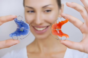 Woman holding dental retainers.