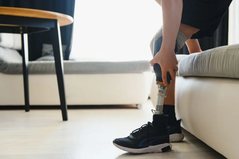 Man with prosthetic leg.