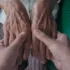 Spouse, Caregiver, or Both? How Chronic Illness Redraws the Lines in a Marriage