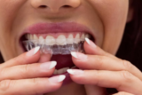 Does Invisalign Cause Pain? Let’s Bust This Myth.