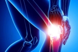 Understanding 5 Common Knee Injuries and Navigating Long-Term Management