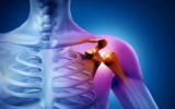 How to Stay Fit and Active During Shoulder Injury Recovery