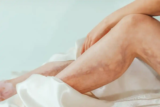 What Actually Causes Varicose Veins and Why Some People Are More Vulnerable Than Others